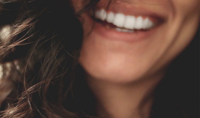 ¿Cómo conseguir una sonrisa perfecta?