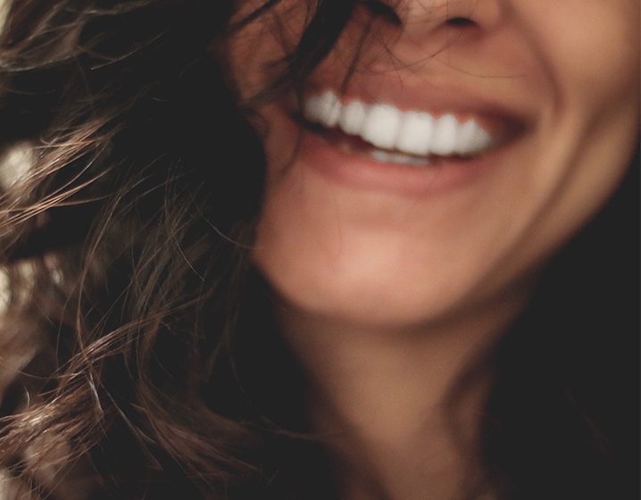 ¿Cómo conseguir una sonrisa perfecta?