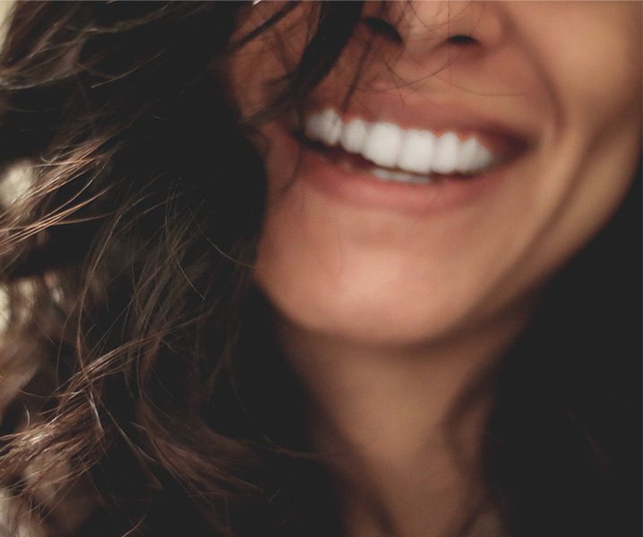 ¿Cómo conseguir una sonrisa perfecta?