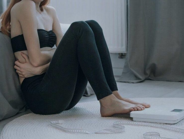 anorexia