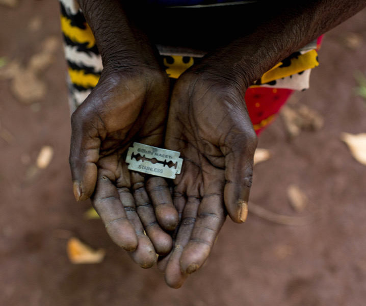 mutilación genital femenina